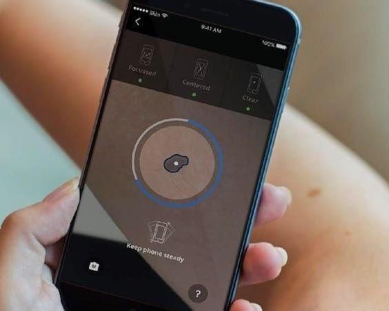 Google внедряет функцию сканирования кожи. Теперь станет проще узнать, чем вы болеете